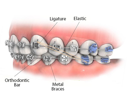 التقويم و الحاصرات
