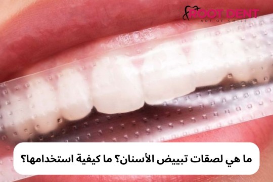 ماهي لصقات تبييض الأسنان؟ وكيف تعمل؟