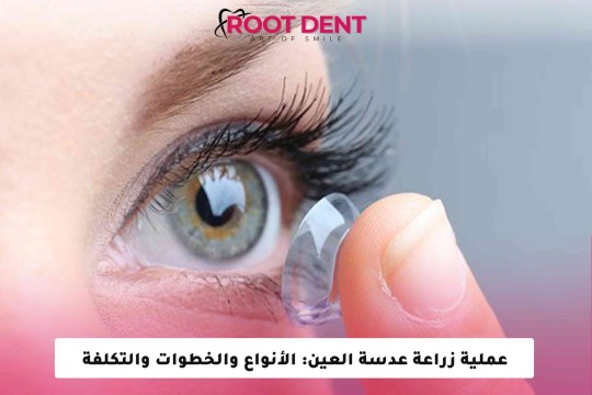 عملية زراعة عدسة العين: الأنواع والخطوات والتكلفة